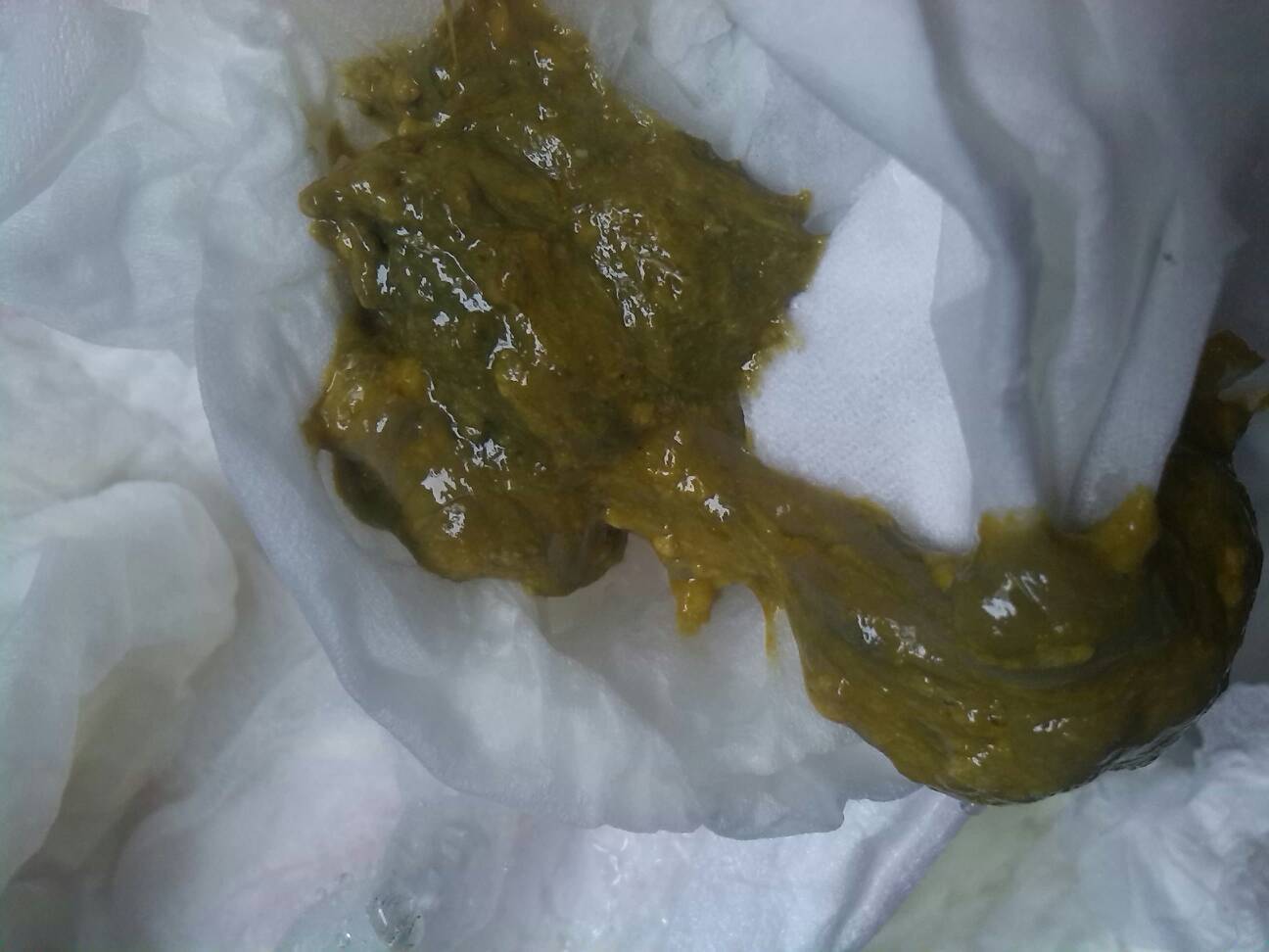 吃奶粉的宝宝拉这样的粑粑正常吗