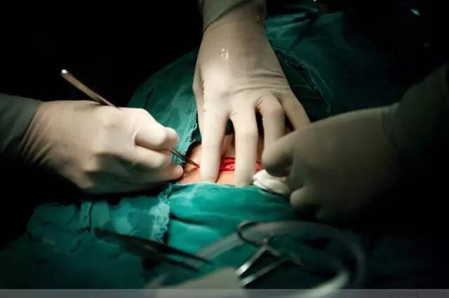 100张照片,真实记录"剖腹产"全程!胆小者慎入!