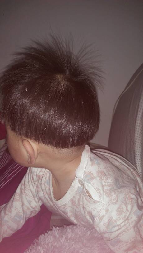 宝宝头发头顶那一直是朝上长得,长长了还是直的