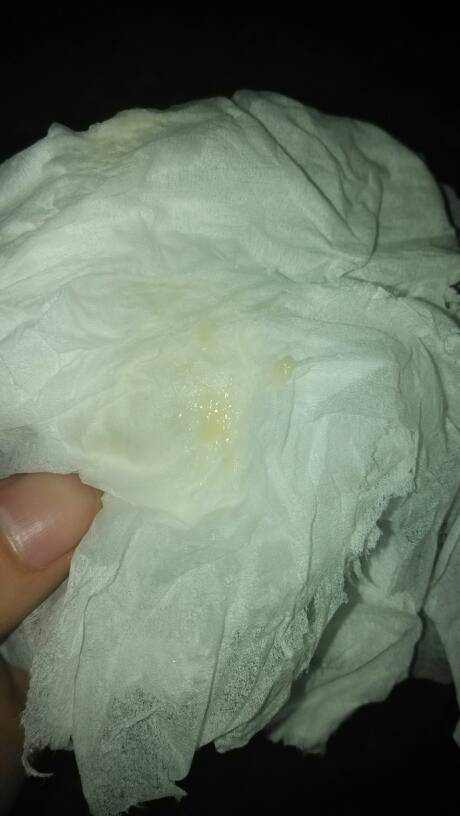 怀孕8周,分泌这样颜色的白带,正常吗?