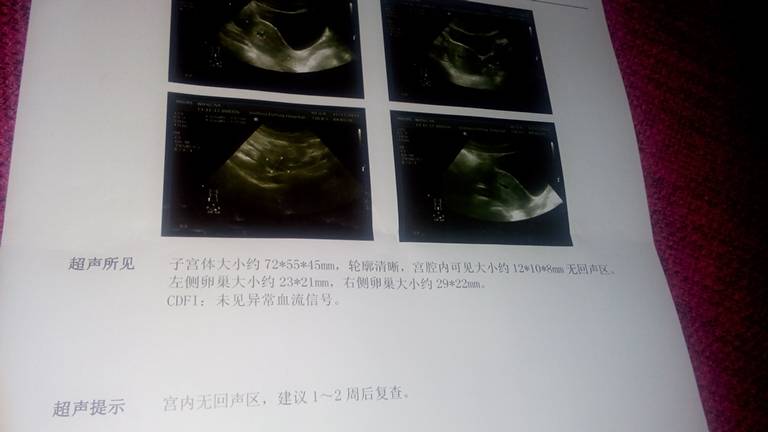 我从怀孕35天到现在一直有褐色分泌物今天特多黑褐色的好怕这个是我