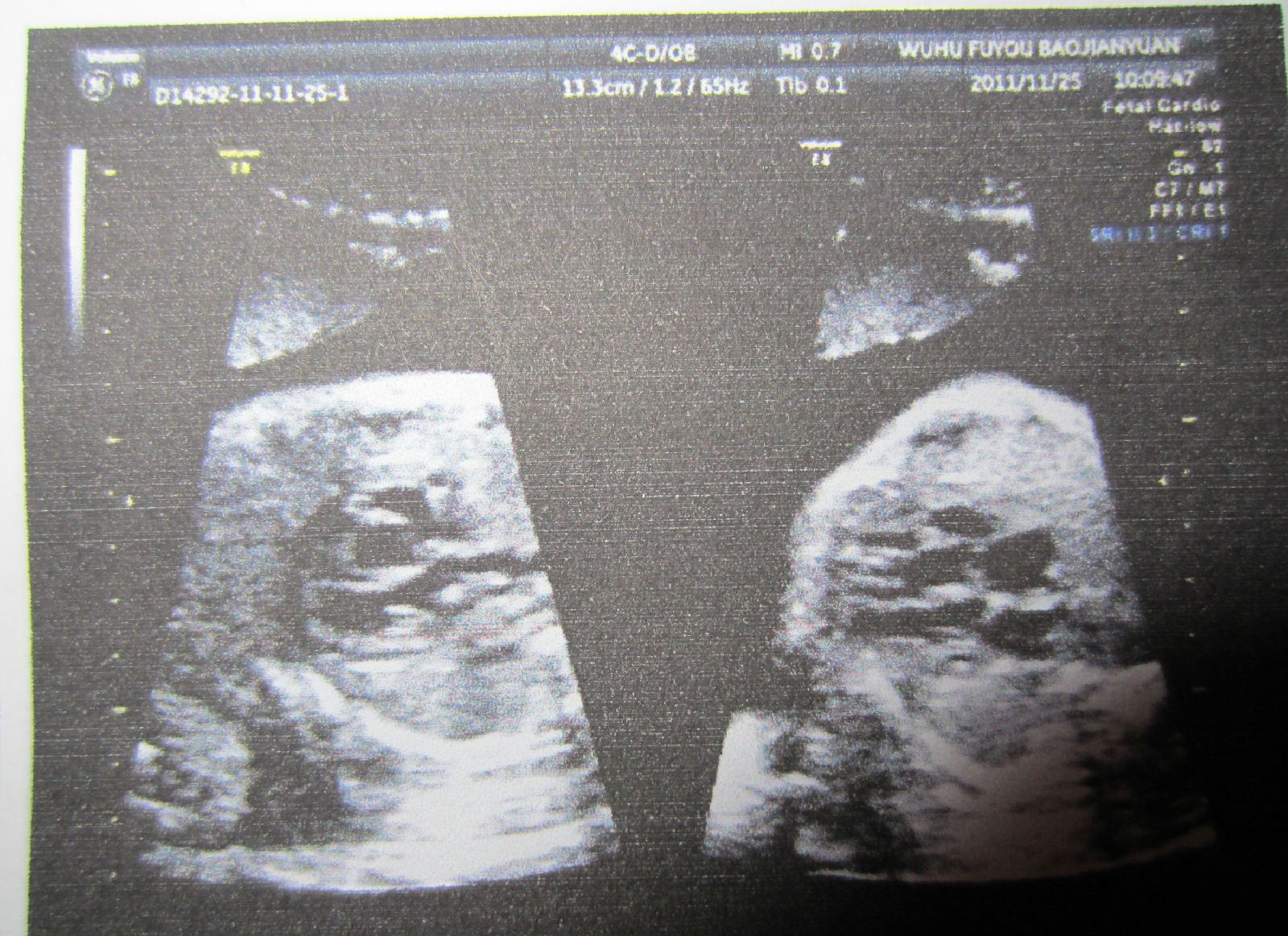 双胞胎宝宝秀 （双胞照片贴图大集合 ）_2007年_同龄圈_摇篮论坛