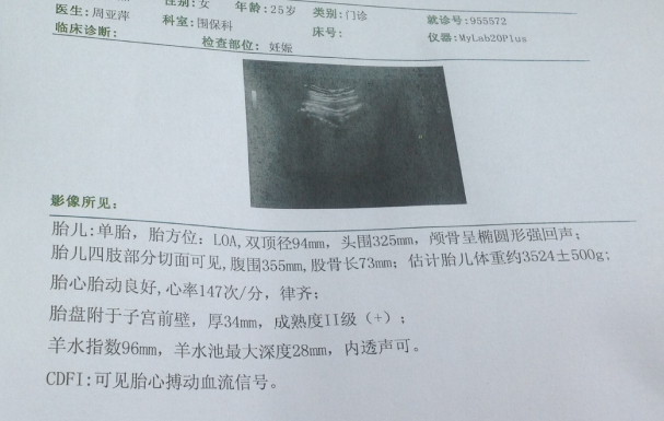 38周 羊水指數96mm 最大深度28mm,醫生說羊水深度不夠