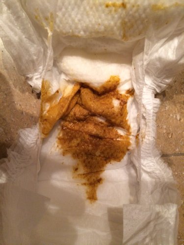 宝贝两个半月，纯母乳喂养，之前大便很正常是金黄色，这几天突然变成了深黄色，有点偏棕色（如图），请问