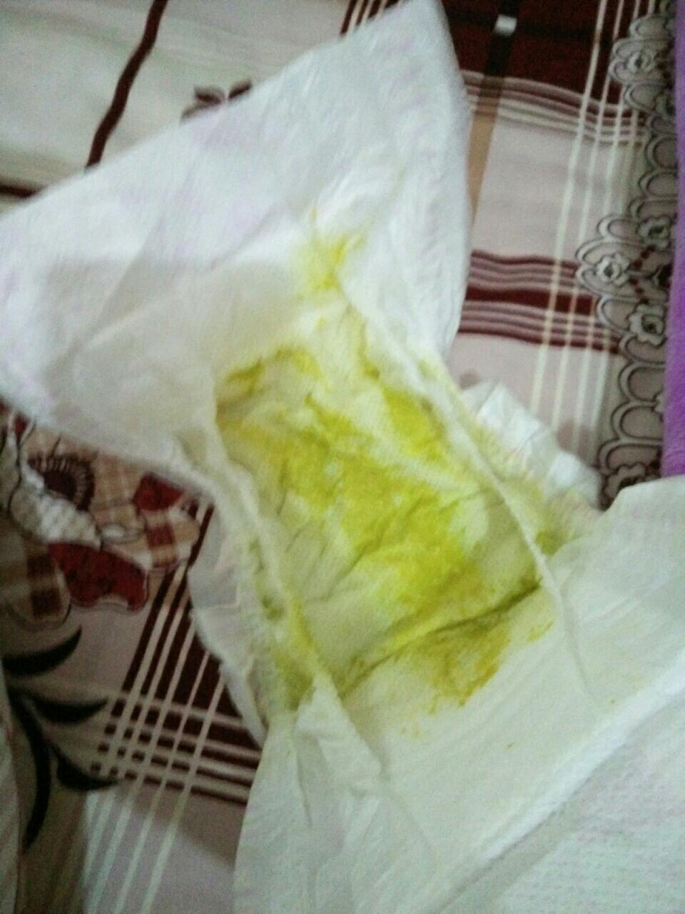 > 帖子详情4楼 多美滋1000日计划:应该是母乳性腹泻,喝母乳的宝宝一天