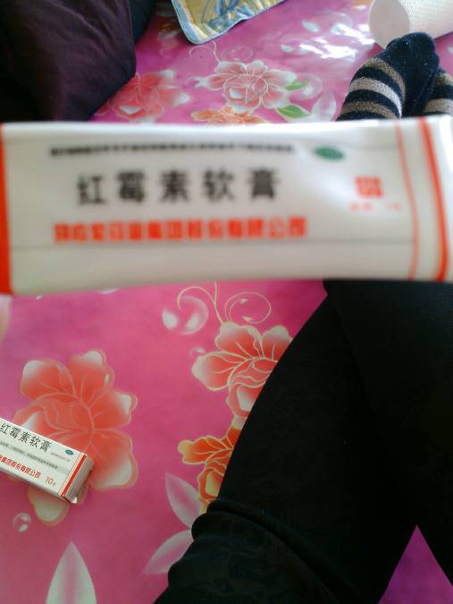 有哪位宝妈的宝宝是尿布疹治好的