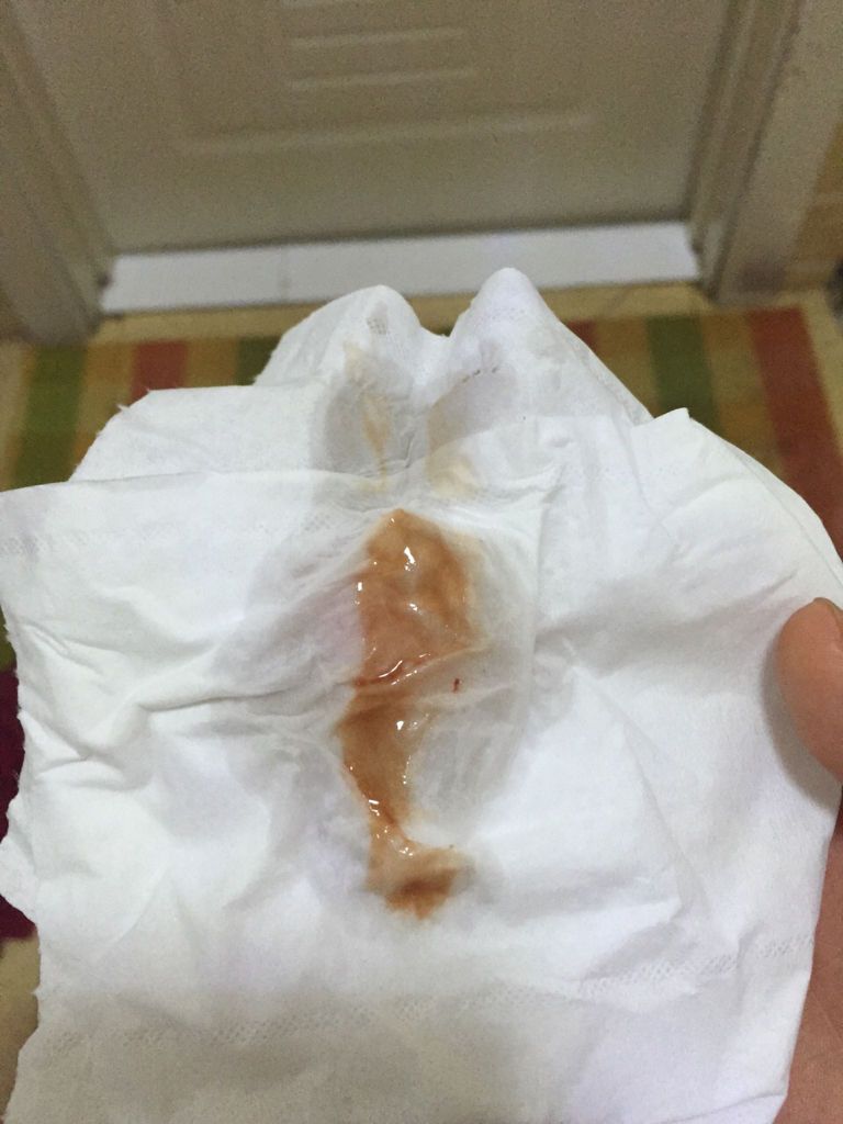 怀孕12周加3突然见红色血但是11周加6的时候做nt孩子非常健康怎么回事