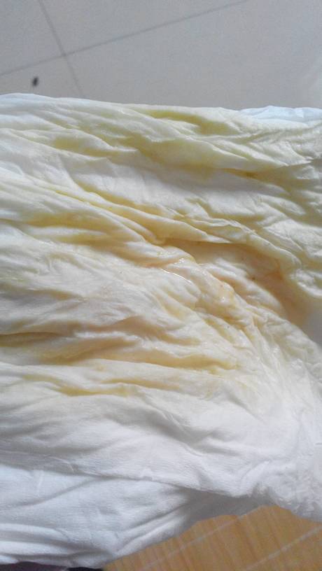 这是羊水吗,流的跟尿不尽一样～昨天见红了,到现在肚子还不痛