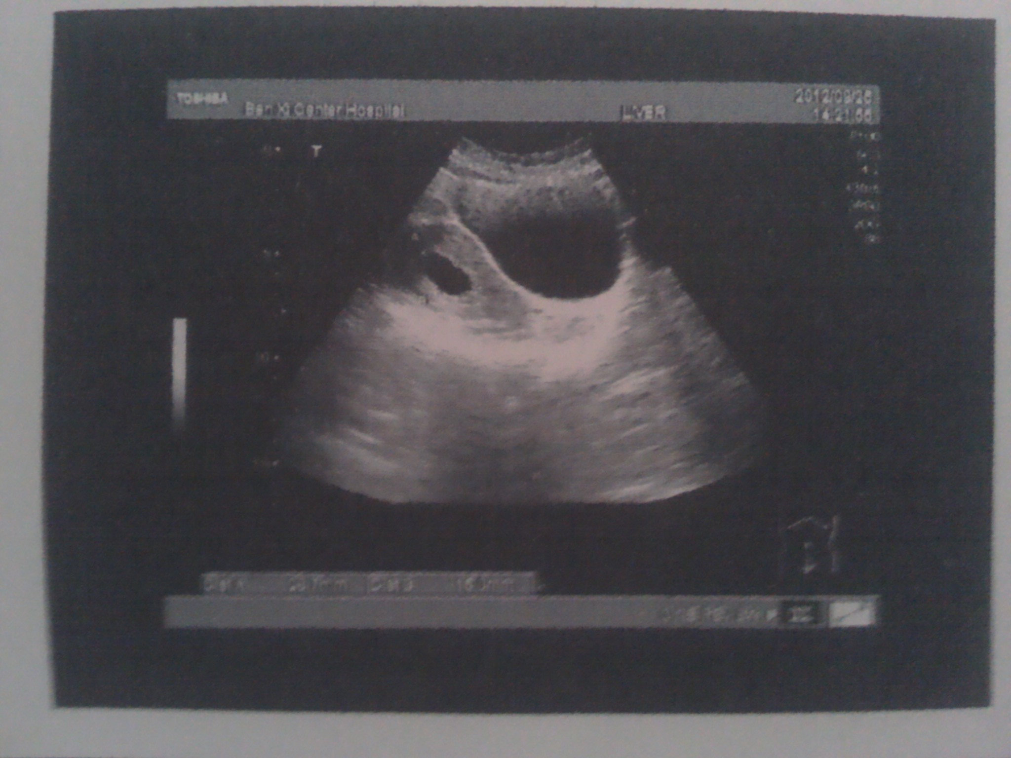 怀孕一个月的胎儿_怀孕13周胎儿图_怀孕4个月胎儿图_怀孕53天胎儿的样子 - 黑马素材网