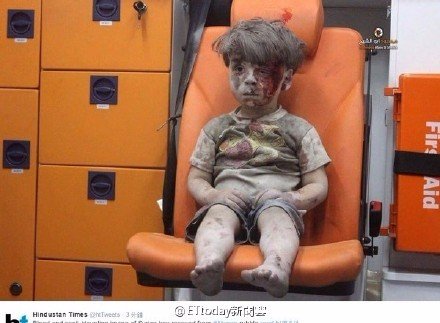 5岁的叙利亚小男孩omran满脸血与灰的照片,虽然他没哭,但是我哭了,真