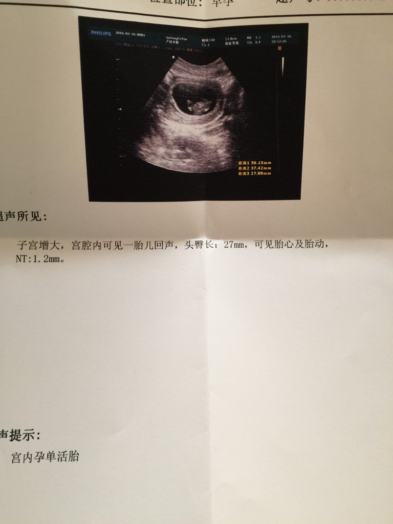 怀孕80天了,早上稍微有点孕期反应,洗了个澡洗了点衣服,,感觉好饿好饿