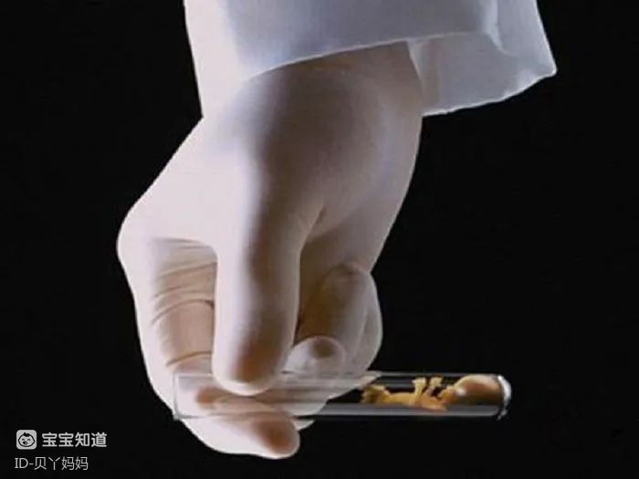 通过xy精子分离术人工筛选精子生男孩需要多少钱
