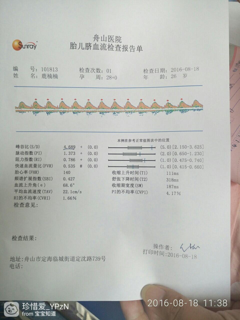 这个胎儿脐血流s/d有点高谁知道怎么解决？