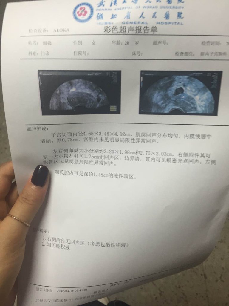 宫外孕后做了微创手术后一个月拍的阴超 懂的人帮忙看看是不是正常