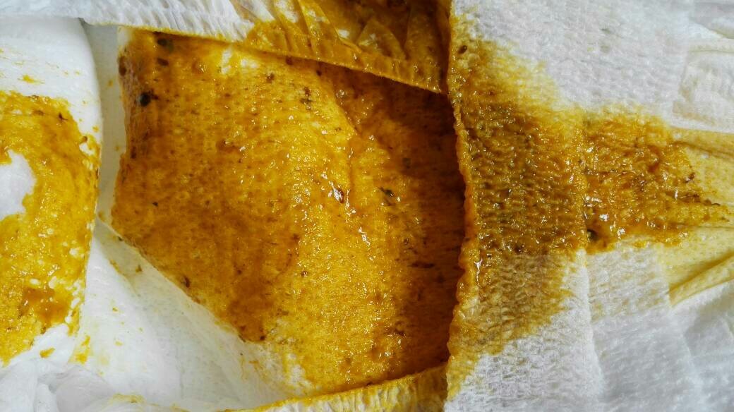 三个月的宝宝,拉的粑粑怎么会有黑色杂质,是什么啊?