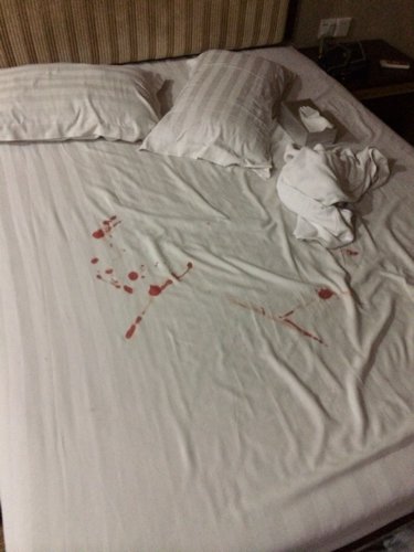 大姨妈前10天 第一次 请我这处女血正常吗