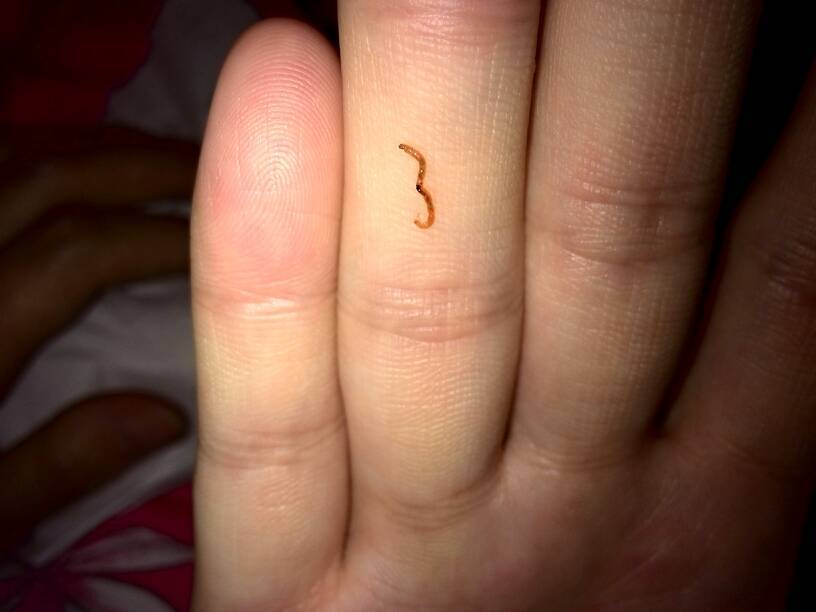 怀孕33周多了,反复出血,但又不多,出一下又没有了,有一次发现血里有条