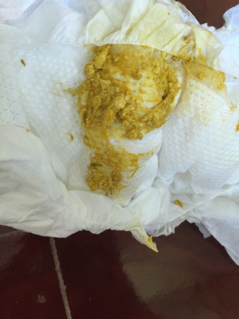 23天的新生儿肚子老是咕咕响,每次拉屎都带走很多颗粒物!图片恶心哈