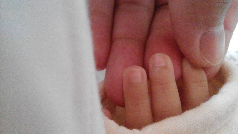 宝宝38天了,手指甲末端皮肤发黑,是什么原因,照的不明显