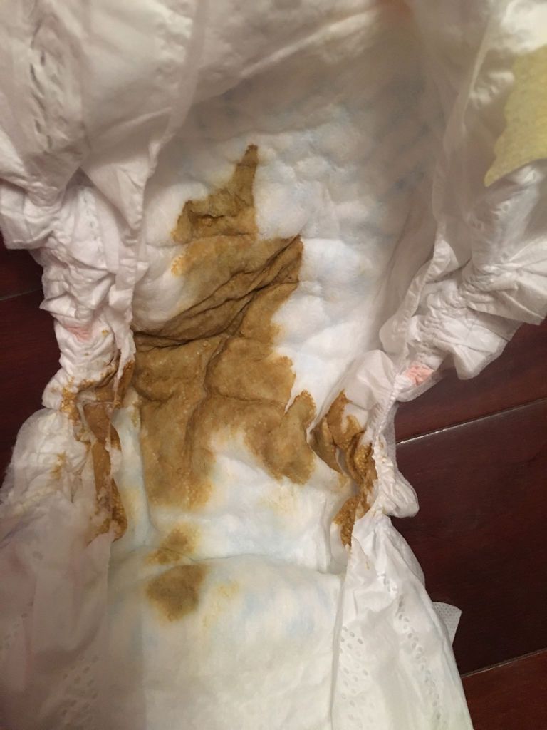 问:一个月二十天的宝宝拉屎很稀怎么回事?是拉肚子了吗?