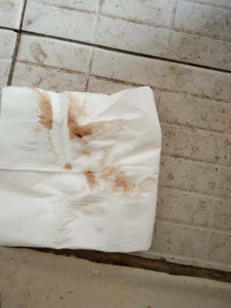 我怀孕五周了,今天见红了,有没有事?