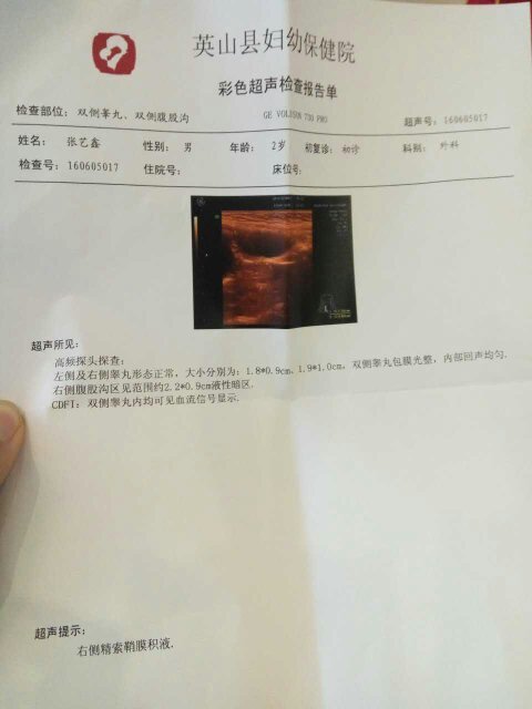 孩子一个多月的时候检查出睾丸鞘膜积液,现在两岁检查为精索鞘膜积液