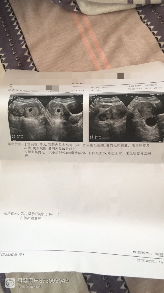 怀孕5周的彩超图片图片