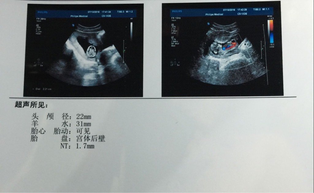 nt看男女,自己就会啦