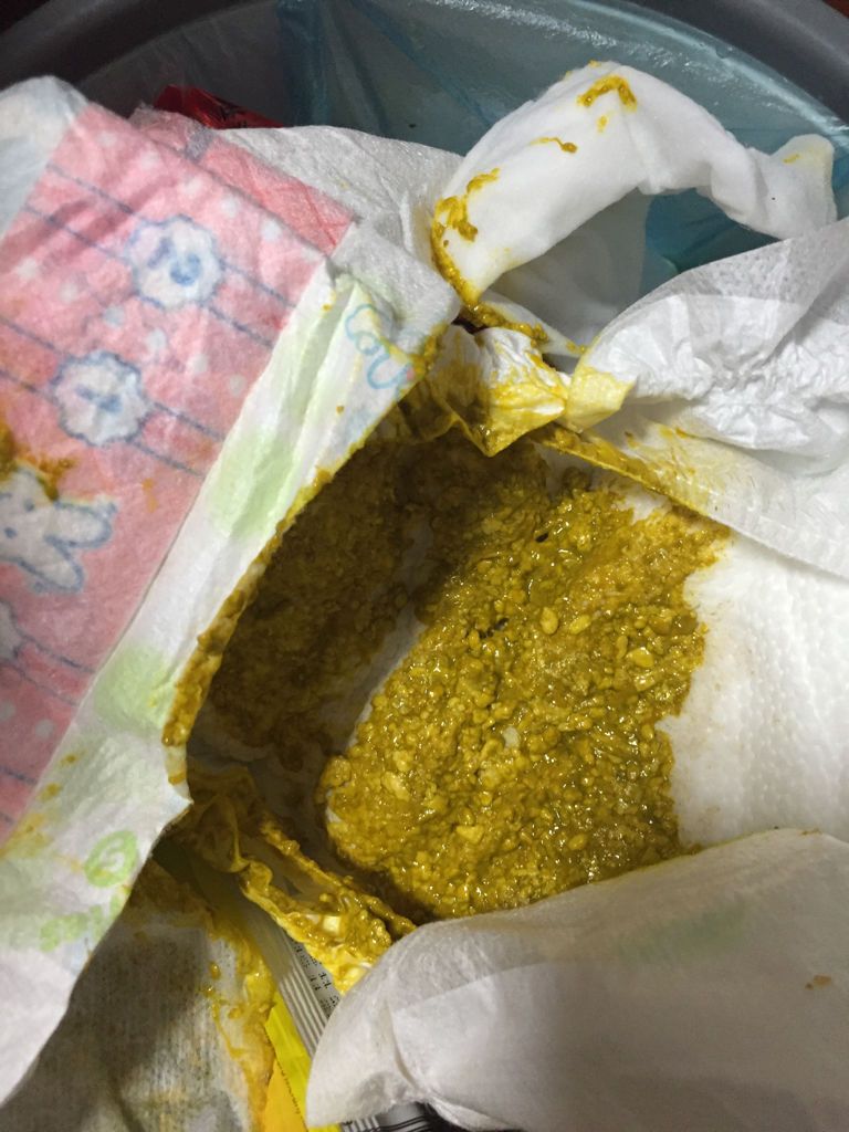 宝宝的大便这样的 求助！