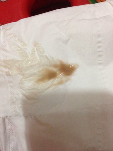 怀孕后白带这种,会不会先兆流产?