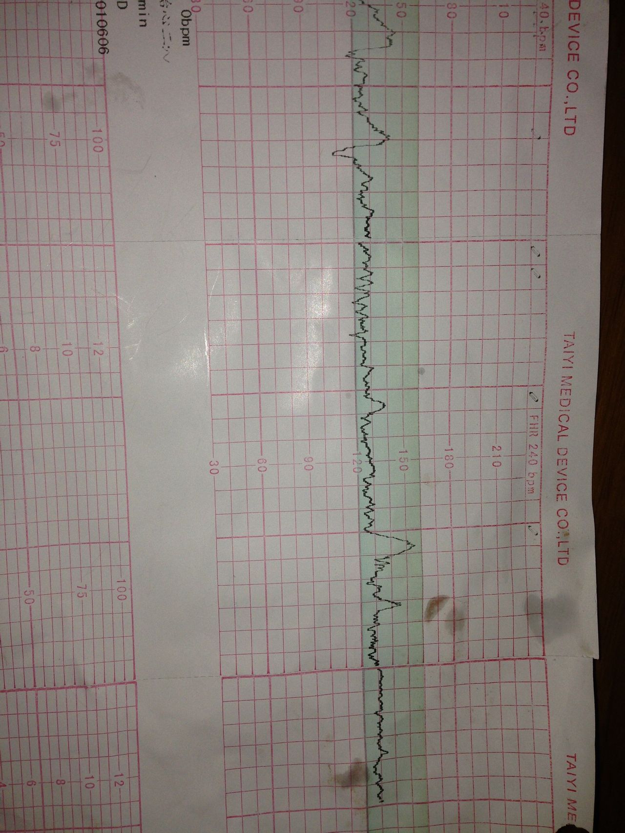 问答 问答首页  为您推荐: 其他回答 你好,胎心率是正常的,变异也挺好