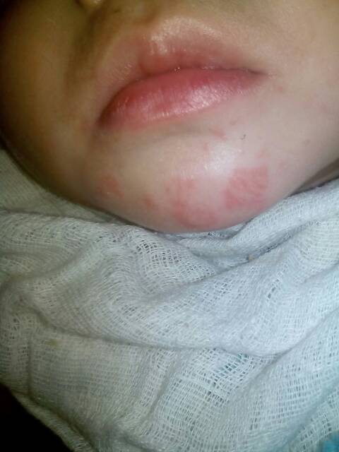 大家帮我看一下这是张的什么?