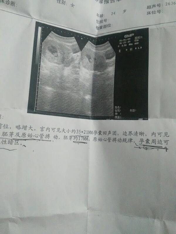 怀孕49天胎儿发育图片图片