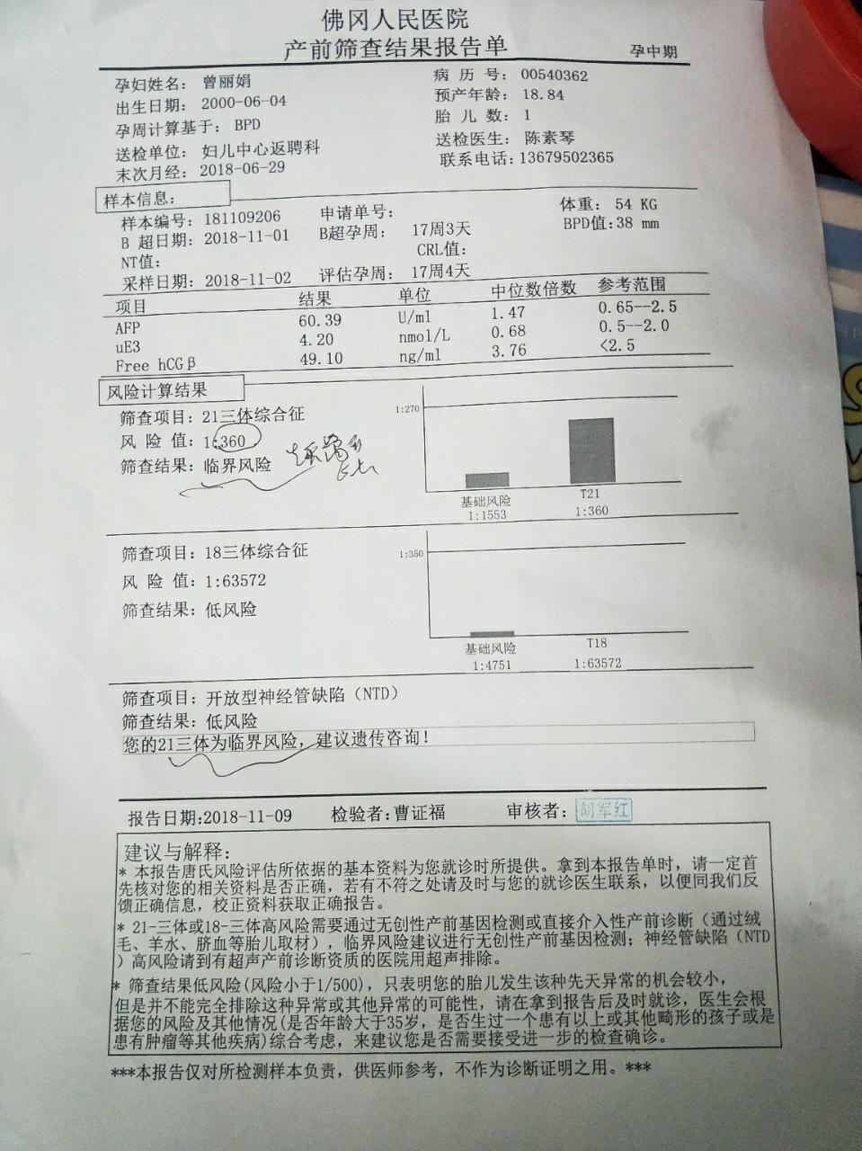 21三體綜合徵檢查臨界風險1:360 不知道咋麼辦