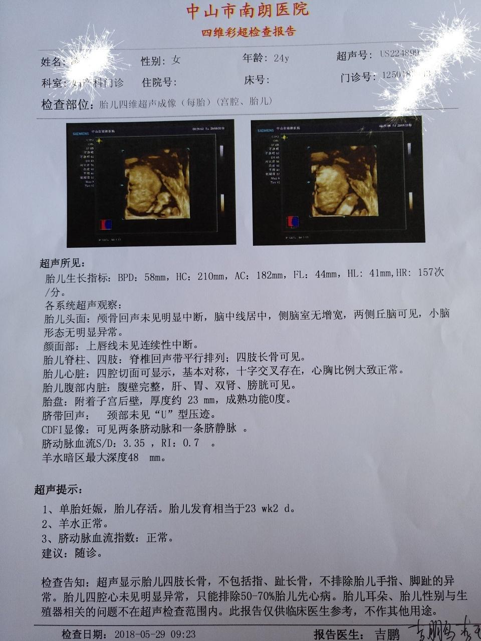 怀孕27周四维彩超图片