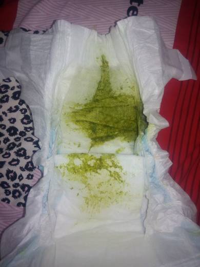 三个月的宝宝拉的粑粑是绿色的,这是怎么回事呀,有医生在吗?急急急