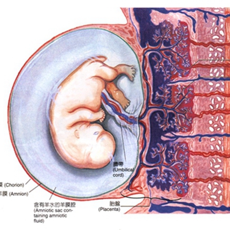 膜状胎盘图片 示意图图片