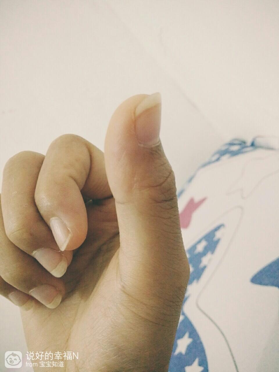 手上大拇指疼痛是什么原因？