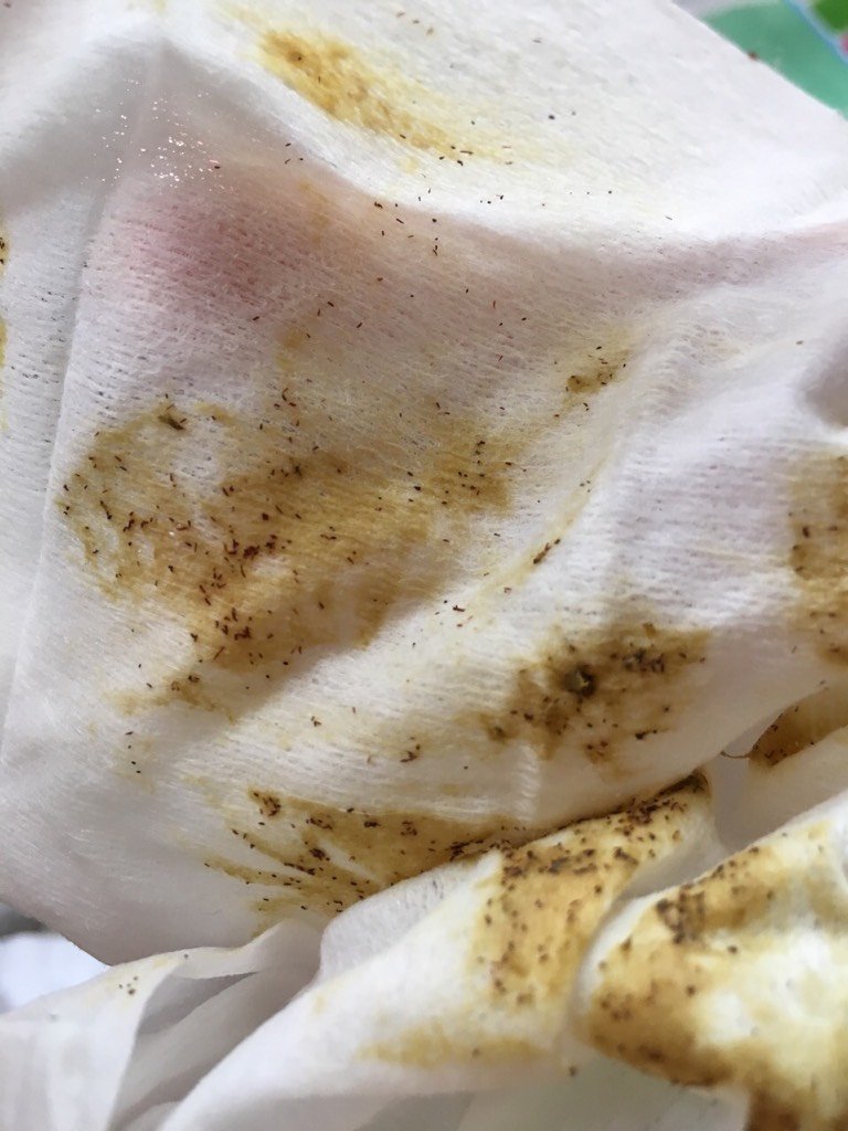 宝宝吃了柿子拉大便有黑色的渣子,怎么回事?