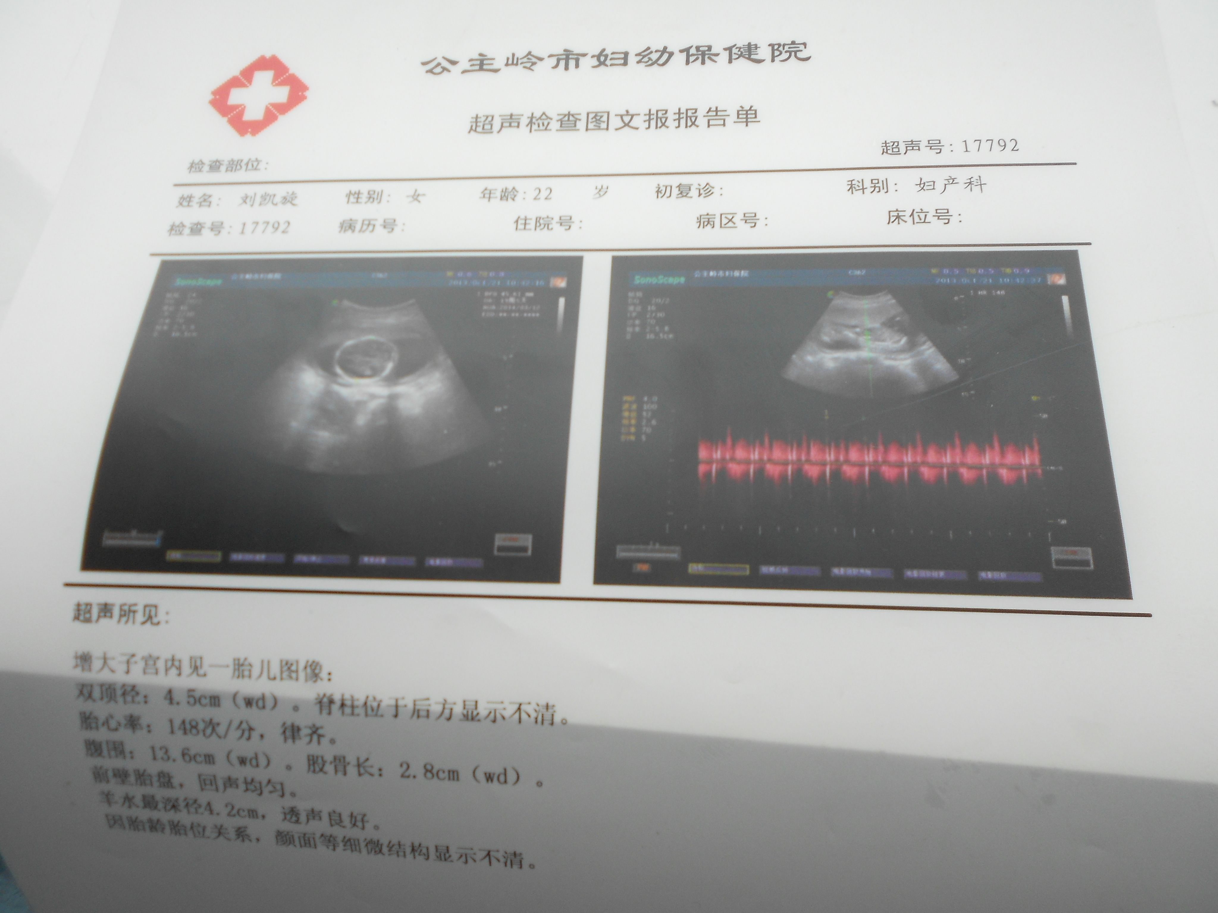 怀孕50天B超图显示如下，孕囊一般是三个数据，至少也两个，为何该医院只给出一个？ - 百度宝宝知道