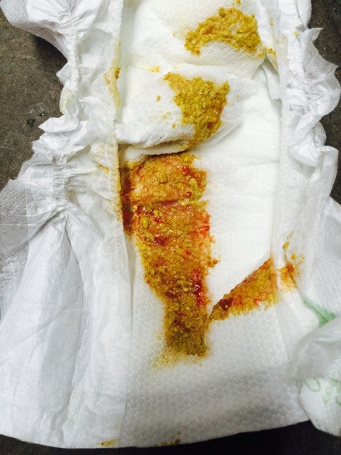 三个月一天拉屎6,7次,有点稀,还有点带血