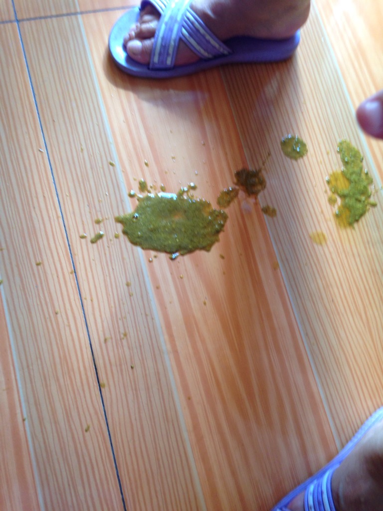 的 蜡笔小妞    2014-08-16 09:16 你家宝宝大便绿色是消化不良引起的