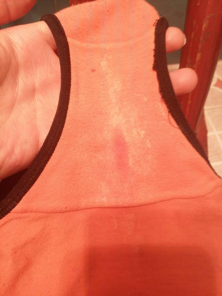 月经后几天感觉白带有点多,麻烦医生帮忙看下,谢谢了