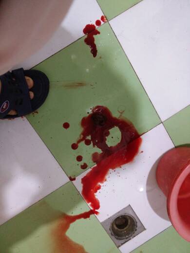 月子里几天都不上厕所,上一次就拉不出来,大便干燥 第一次有轻微出血