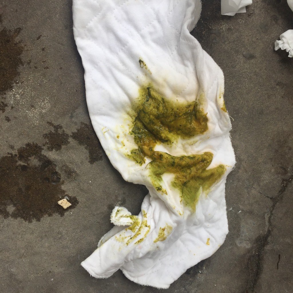 宝宝2个月11天,拉大便是这样的,这样的是拉肚子吗,吃了好多药都没有