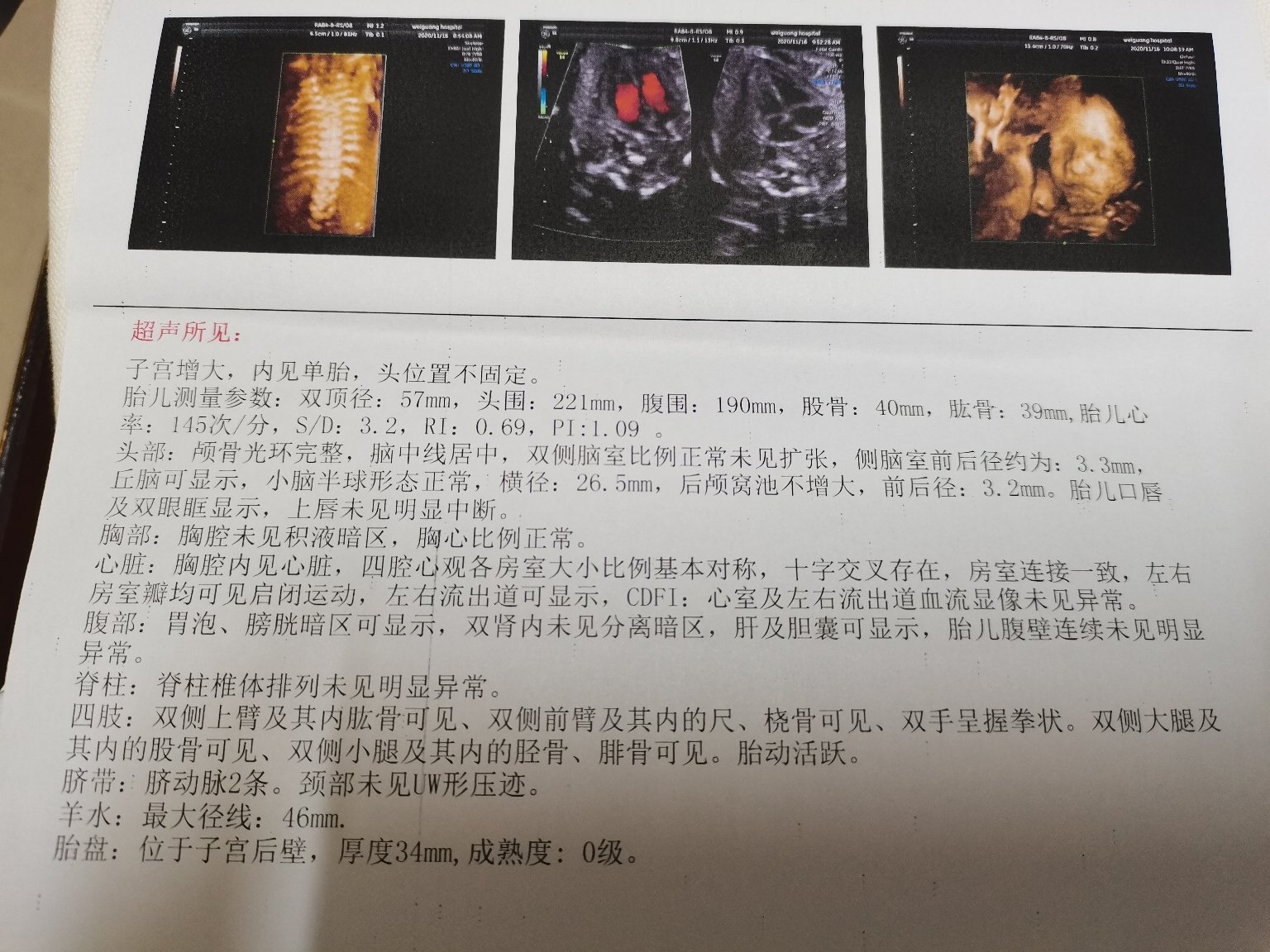 22周1四维彩超顺利通过,宝宝全程很配合