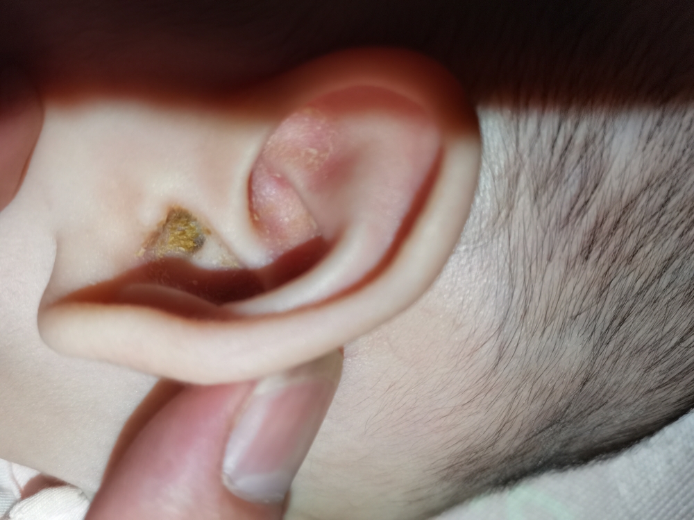 四个多月的宝宝耳朵里有这种黄黄的东西我之前有棉签擦过还用指甲掏过