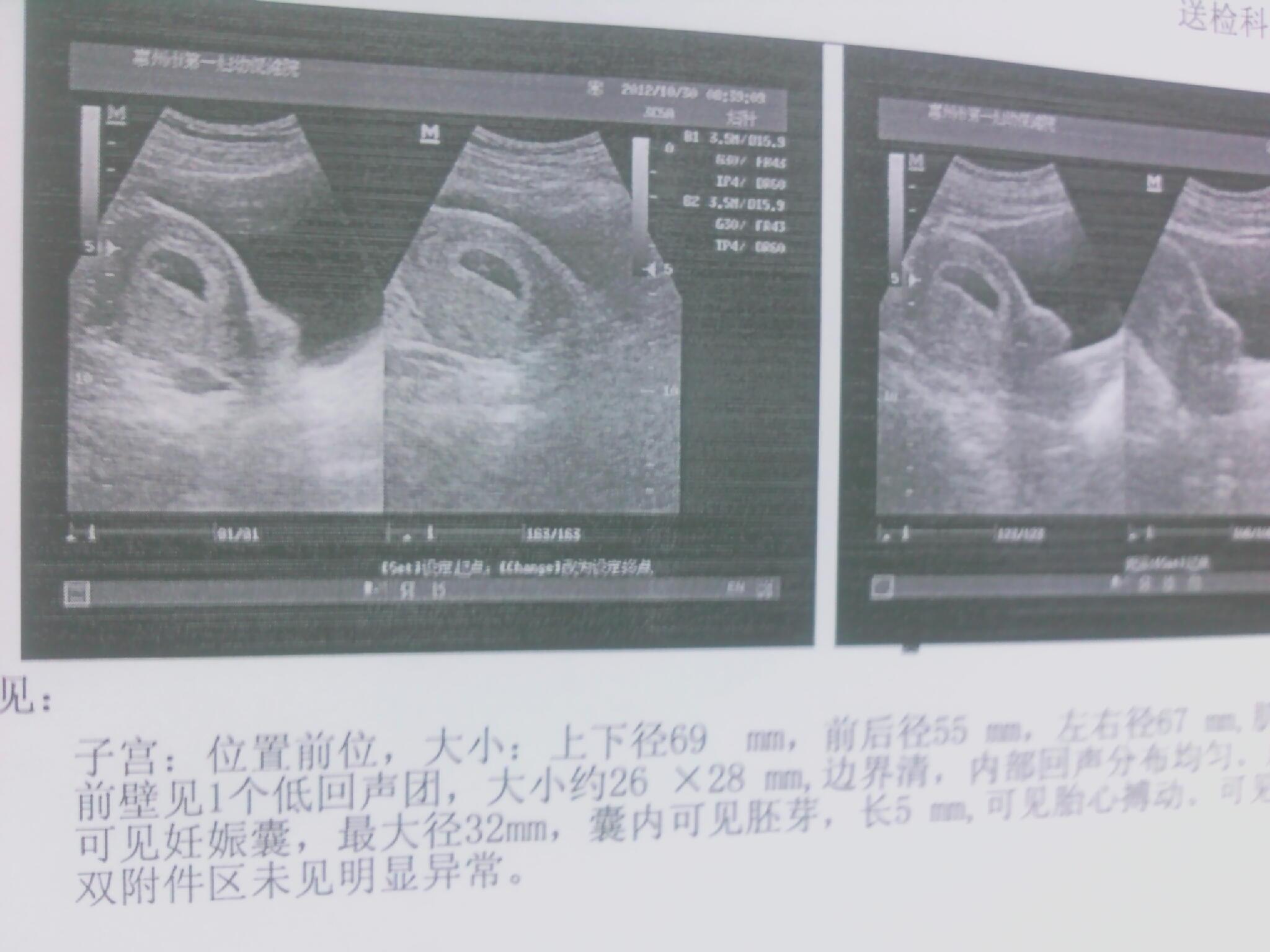 六个月孕妇肚子多大 请看美女六个月怀孕写真-1-6TU