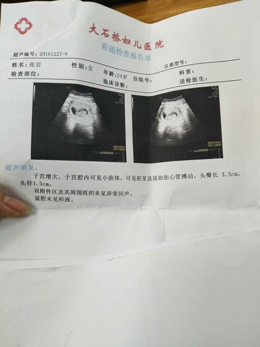 怀孕早期彩超图片