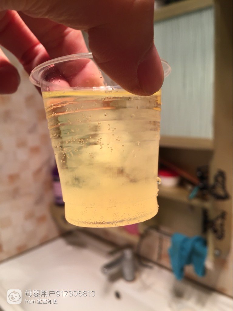 酒精尿液测试男女,懂的帮忙看看